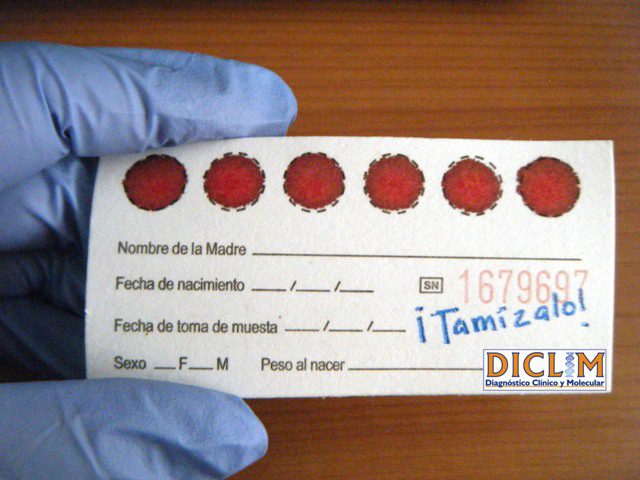 Tamiz Neonatal
