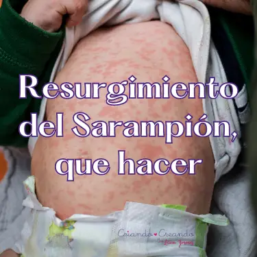 Resurgimiento del Sarampión, acciones a tomar.