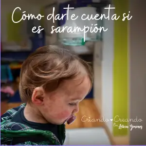 Cómo darte cuenta si tu hijo tiene sarampión