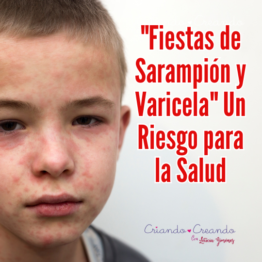 «Fiestas de Sarampión y Varicela» Un Riesgo para la Salud